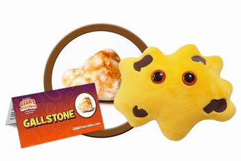 Gallstone