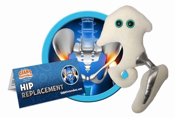 Hip Replacement
